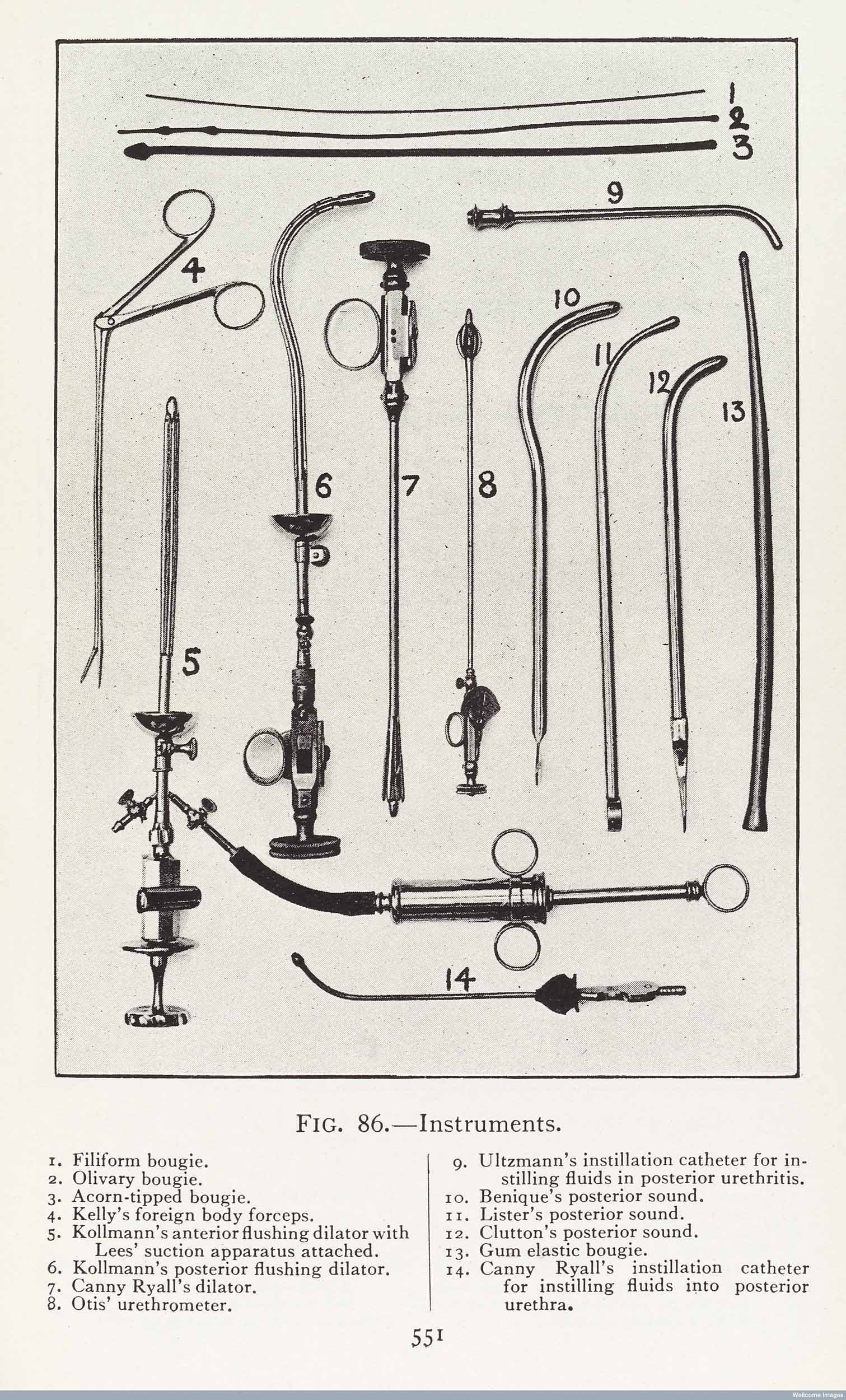 Surgical instruments used to treat venereal diseases. Copyright Wellcome Library, London. Creative Commons Attribution 4.0 International (https://creativecommons.org/licenses/by/4.0/).