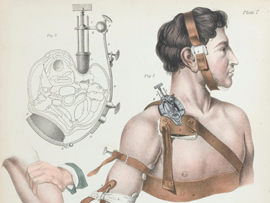 'Operative surgery.' Copyright Wellcome Library, London. CC BY 4.0 'Operative surgery.' Copyright Wellcome Library, London. CC BY 4.0